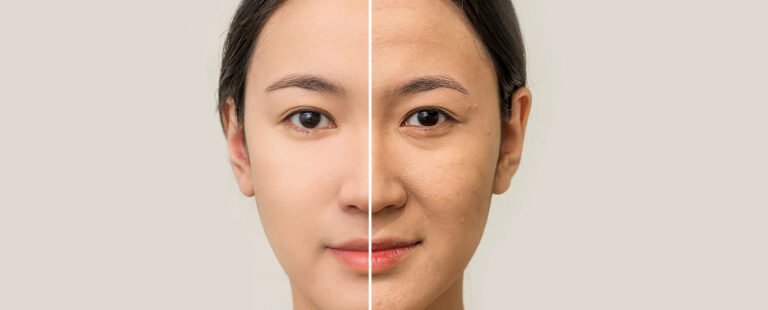 Cara Merawat Kulit Wajah agar Terlihat Glowing Alami