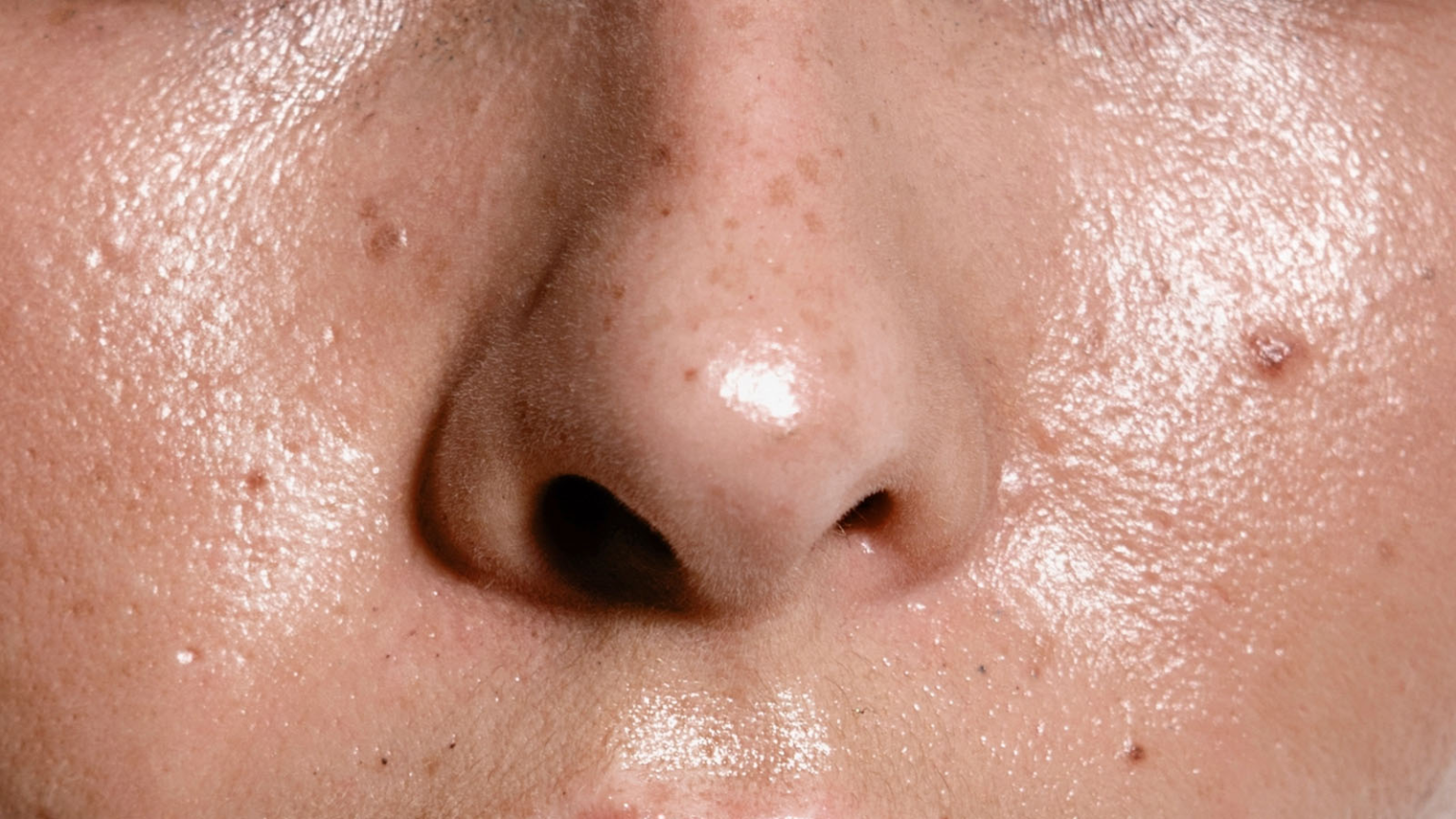 Tips Skincare untuk Kulit Berminyak agar Tidak Mudah Berjerawat