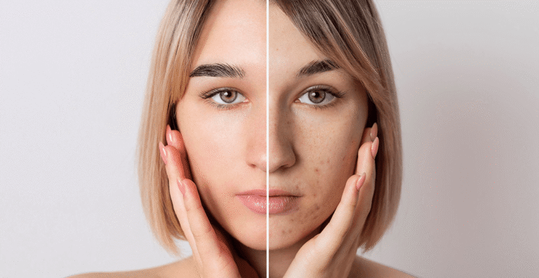 Tips Skincare agar Kulit Tidak Mudah Kusam